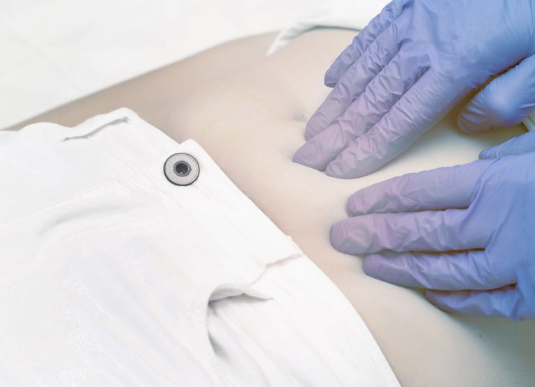 Hernien Christophorus Kliniken